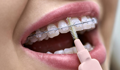 Client at a dentist appointment